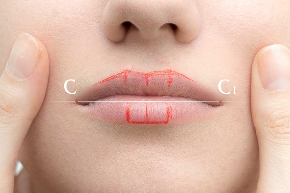 Неровный контур губ после перманентного макияжа